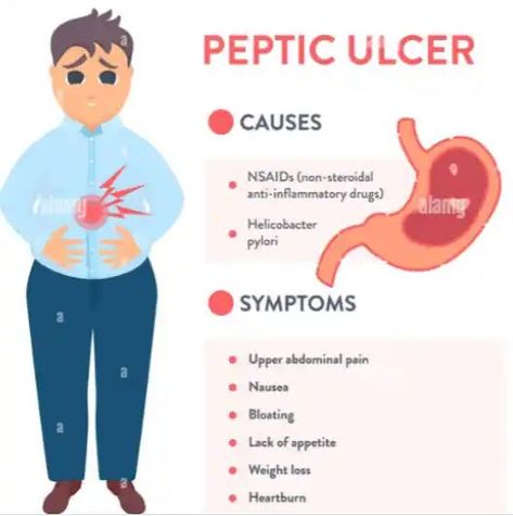 Stomach Ulcers Symptoms, Medicine Knowledge, Ulcer Symptoms, Signs Of Inflammation, Medical Notes, Abdominal Cramps, About Skincare, Nurse Study Notes, Gastrointestinal Disorders