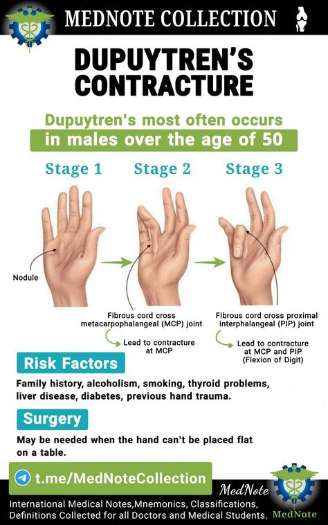 Dupuytren's Contracture, Blood Sugar Level Chart, Summer Health, Doctor Advice, Medical School Essentials, Health And Fitness Magazine, Healthy Diet Tips, Daily Health Tips, Medical Knowledge