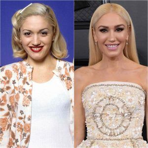 Celebrity Plastic Surgery: 10 Before-and-After Pics | Fly FM Plastic Surgery Pictures, Celebrity Surgery, Aidy Bryant, Gwen Stefani No Doubt, Celebrity Yearbook Photos, Plastic Surgery Gone Wrong, Celebrity Yearbook, Nick Offerman, Celebrity Plastic Surgery