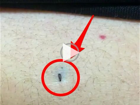 ▷ ▷A short video on Instagram proves that some blackheads hide their heft below the skin's surface. diy home decor projects creative ideas, diy home decor wall shelves, farmhouse decor, diy decor..!!