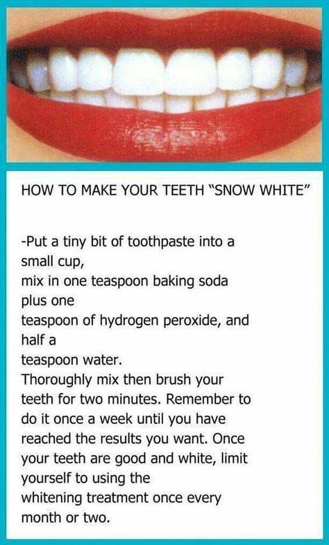 Baking Soda Teeth, Baking Soda Teeth Whitening, Teeth Whitening Homemade, Teeth Whitening Remedies, Teeth Whitening Diy, Diy Teething, Teeth Health, Best Teeth Whitening, Natural Teeth Whitening