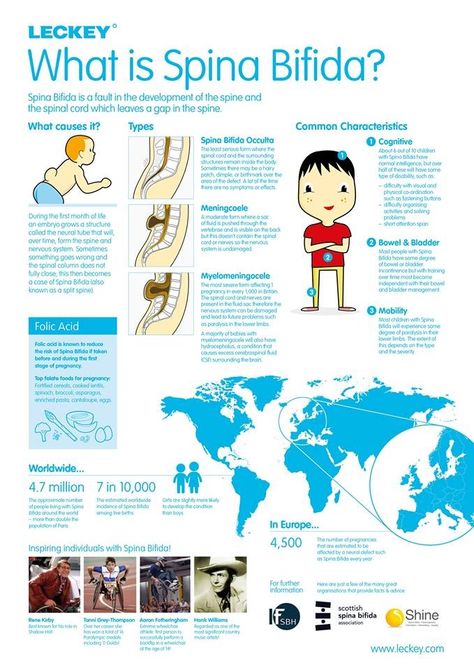 Spina Bifida facts. I'm pinning this as it's the last day of Soina Bifida and Hydroceohalus Awareness week 2013 . I know people with Spina Bifida Nicu Nursing, Spina Bifida Awareness, Med Surg Nursing, Pediatric Physical Therapy, Ob Nursing, Spina Bifida, Physical Disabilities, Nursing Tips, Nicu Nurse