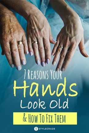 Hand Care Anti Aging, Hands Care, Wrinkles Hands, Natural Skin Care Remedies, Skin Care Wrinkles, Glow Skin, Anti Aging Skin, Look Older, Skin Care Remedies