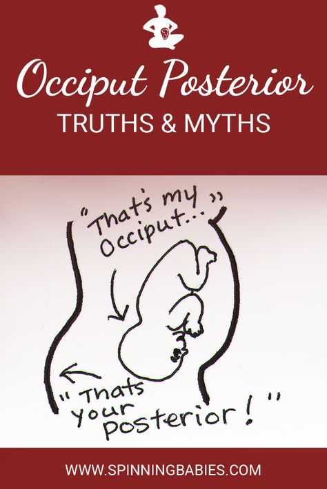 OP Truths & Myths - Spinning Babies Posterior Baby, Anterior Placenta, Birth Hospital, Pregnancy Due Date, Spinning Babies, Labor Tips, Birth Worker, Natural Childbirth, Fetal Position