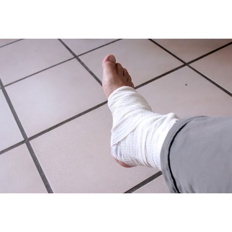 Embracing a willingness to train around injuries is the mark of a champion (or at least the mark of someone who is dedicated to achieving fitness). If you have broken your ankle, weight-bearing ... Broke Leg Snapchat, Broken Fibula, Injury Aesthetic, Fake Injury, Moral Orel, Broken Foot, Ankle Surgery, Bed Bug Bites, Broken Ankle