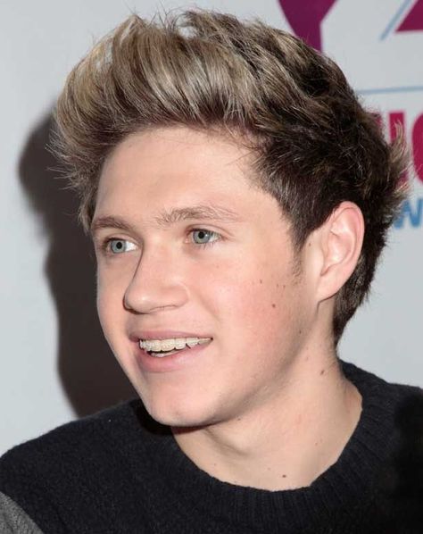 Niall Horan Braces, Celebrities With Braces, Adult Braces, Clear Braces, One Direction Niall, Brace Face, Teeth Braces, Irish Princess, Tv Fashion