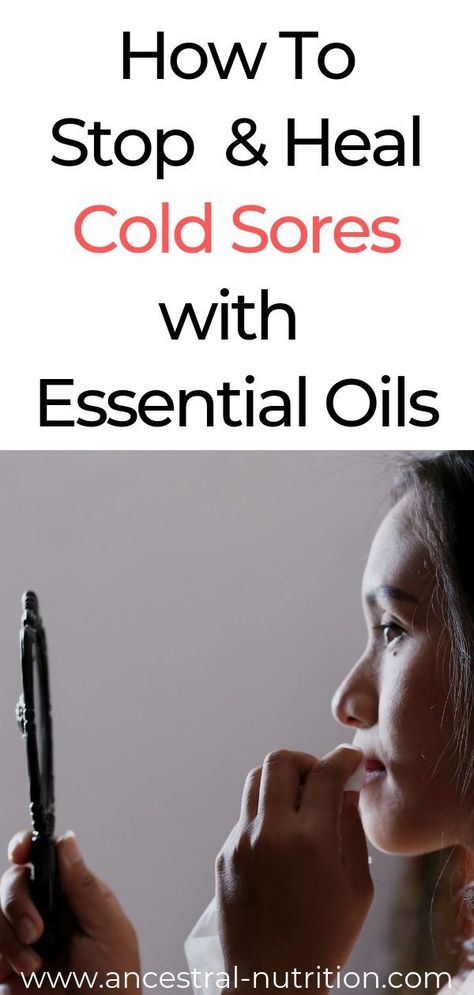 How to stop and heal cold sores using Essential Oils! This is the most effective and most natural way of getting rid of nasty cold sores caused by Herpes Simplex Virus 1 #coldsores #health #beauty #remedies #essentialoils Essential Oils For Cold Sores On Lip, Diy Cold Sore Remedy Fast, Cold Sore Remedy Overnight, Essential Oils For Cold Sores, Cold Sore Essential Oil, Cold Sore Remedy, Essential Oil Blends For Colds, Natural Cold Sore Remedy, Ancestral Nutrition