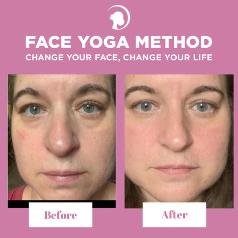 #TRANSFORMATIONTUESDAY 😲😲😲  Wow Tammy, what an incredible transformation! 👏   Start your transformation for free today! 🏃‍♀️   #eyes #faceyogamethod Exercise Face, Brighten Eyes, Forehead Lines, Face Yoga Method, Face Yoga Facial Exercises, Eye Brightener, Face Exercises, Yoga Facial, Eye Lift