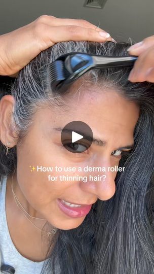 861K views · 2.7K reactions | Important tips for hair thinning! #hair #thinning #thinninghairsolution | Kirtitewani Hair Thinning At Crown, Thinning Hairline, Tips For Hair, Kim Hair, Hair Thinning, Thinning Hair, For Hair, Hair Ideas, Hair Hair