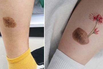 Birth Mark Cover Up Tattoo, Tattoo Birthmark Coverup, Tattoo Around Birthmark, Small Tattoo To Cover Scar, Tattoo Over Birth Mark, Birthmark Cover Up Tattoo, Mole Cover Up Tattoo Ideas, Small Scar Cover Up Tattoo, Birthmark Tattoo Ideas