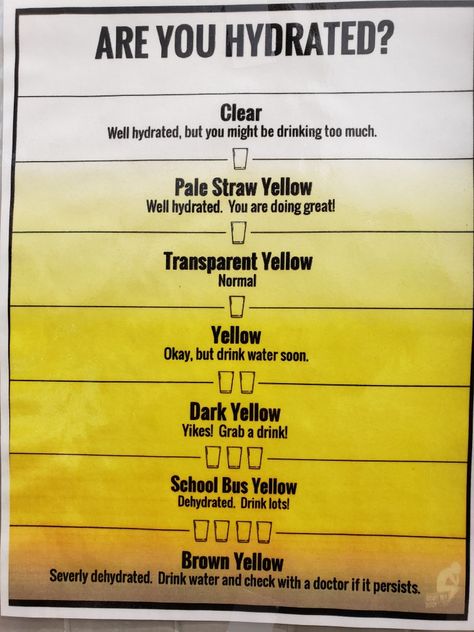 A color chart about your pee and how hydrated you are. Pee Color Chart, Pee Chart, Pee Color, Health Corner, Holistic Diet, Paintings Pictures, Feeling Song, Paper Work, Kidney Health