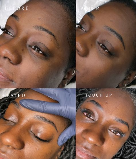 Good brows DO make a huge difference. And when Ombre Powder brows is done correctly by a brow specialist, they can look natural too! If you have any questions about powder brows, DM me or book a free virtual consultation __________________________ •Location: Orlando, Florida •Technique: Microshading •Procedure Duration: 3-4 hrs •Pain level: Minimal to none •Healing time: 7-14 days •Brows will lighten and shrink up to 30% •Touch-Up required 6-8 weeks after initial appointment •Lasts 1-3... Brow Specialist, Good Brows, Ombre Powder Brows, Virtual Consultation, Powder Brows, Orlando Florida, Touch Up, 8 Weeks, Dm Me