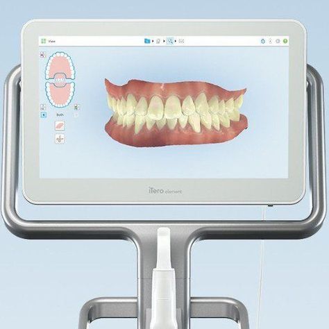 Itero Scanner, Intraoral Scanner, Severe Tooth Pain, Medical Device Design, Dental Impressions, Dental Emergency, Dental Braces, Teeth Straightening, 3d Scanner