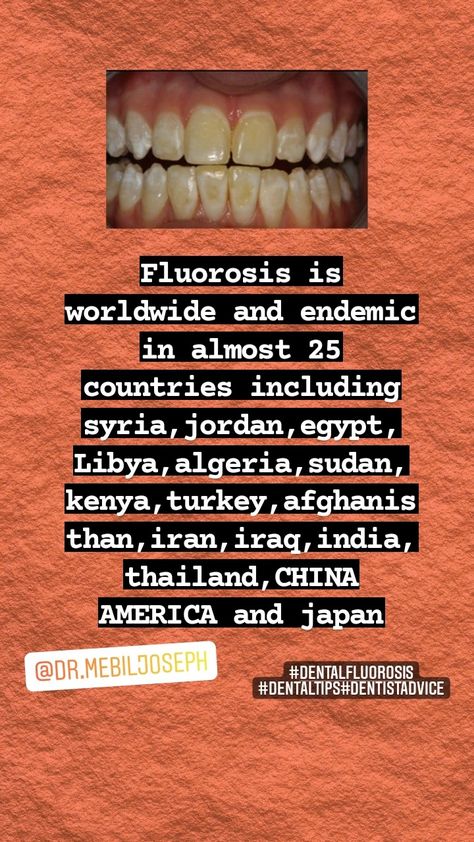 #dentalfluorosis#dentistry#dentist#dentalfact#dentist Dental Fluorosis, Libya, Egypt, Japan