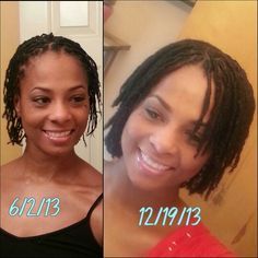 6 months of growth!#starter locs Loc Fashion Black Women, Samantha Baker, Locs Inspiration, Short Twist, Short Twists, Loc Inspiration, Biracial Hair, Sister Locs, Dreads Girl