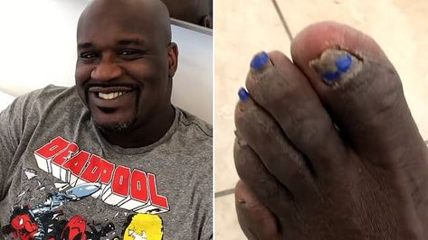 Cheery NBA legend Shaquille O'Neal shows off blue toenail polish says he paints his toenails with 'sparkles and designs' ever since he dropped 40 in a game after getting them painted the first time. Nail Blue, Popular Nail Designs, Toenail Polish, Shaquille O'neal, Toe Nails, Daily Mail, Nba, First Time, Nail Designs