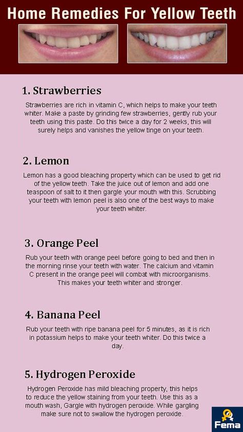 Yellow Teeth Remedy, Teeth Whitening Diy, Plaque Removal, Yellow Teeth, Word Online, Creating A Newsletter, Lemon Peel, White Teeth, Increase Engagement