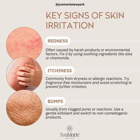 🚨 Key Signs of Skin Irritation 🚨

Does your skin feel irritated? Here’s what to look for:

🔴 Redness: Caused by harsh products or environment. Soothe it with aloe or chamomile.

🌾 Itchiness: Often from dryness or allergies. Use fragrance-free moisturizers and avoid scratching!

🔍 Bumps: Likely clogged pores or reactions. Exfoliate gently and choose non-comedogenic products.

Take care of your skin with the right products and habits! 💆‍♀️ #SkinCareTips #SensitiveSkin #YvaMarieNewYork #HealthySkin Fragrance Free Moisturizer, Take Care Of Your Skin, Skin Irritation, Gentle Exfoliator, Allergic Reaction, Clogged Pores, Skincare Tips, Content Ideas, Fragrance Free