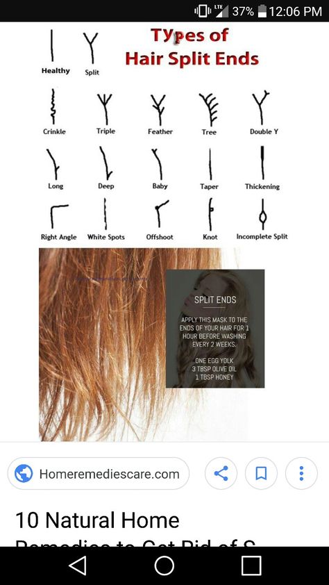 Types of split ends Types Of Split Ends, Split Ends Hair, How To Split, Split End, Embracing Diversity, Hair Growing Tips, Hair Growing, Split Hair, Hairstyle Trends