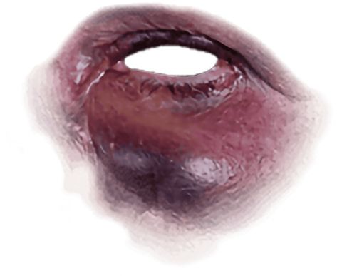 Eye Injury, Graphics Resources, Transparent Image, Image Downloads, Anime Eyes, Eye Black, Png Images, Anime Drawings, Graphic Resources