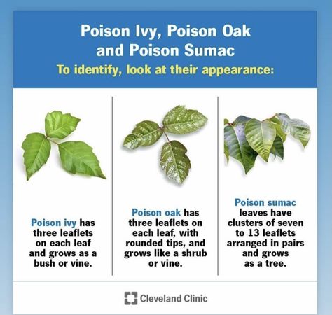 Poison Sumac Rash, Poison Oak Rash, Poison Ivy Leaves, Poison Sumac, Itchy Skin Rash, Poison Ivy Rash, Calamine Lotion, Poison Oak, Itchy Rash