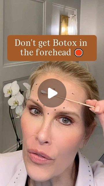 Botox For Hooded Eyelids, Botox Tips, Best Botox Injection Sites, Botox Eyes, Botox Injection Sites Amounts, Preventative Botox Before And After, Natural Botox For Wrinkles Dr. Oz, Botox Brow Lift, Frown Lines