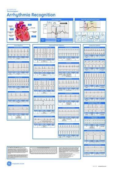 Cardiac Rhythm Cheat Sheet Printable | Arrhythmia recognition Manchester Tan, Nursing Information, Nursing Cheat, Nursing Board, Nursing Mnemonics, Cardiac Nursing, Critical Care Nursing, Respiratory Therapy, Nursing School Studying