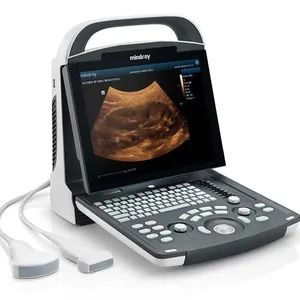 Ultrasound Sonography, Medical Ultrasound, Ultrasound Machine, Muscle Stimulator, Fat Reduction, Ultrasound, Printer, Medical, Black And White