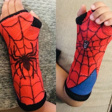 DIY- Blue acrylic paint, and permanent marker used to make a spider man cast’ Arm Cast Painting, Spider Man Cast, Cast Drawing Ideas Arm, Broken Arm Cast, Spiderman Cast, Halloween Cast, Cast Drawing, Kids Cast, Arm Cast