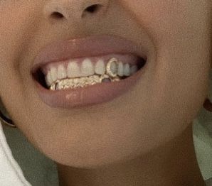 Girls With Grills, Tooth Jewellery, Girl Grillz, Pretty Teeth, Grillz Teeth, Gold Grill, Diamond Teeth, Dope Jewelry Accessories, Tooth Gems