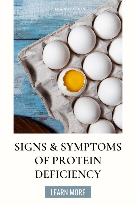 What Is Protein? Protein Deficiency Symptoms, Protein Deficiency, Deficiency Symptoms, Daily Protein, Healthy Diets, Lifestyle Ideas, Skin Issues, Signs And Symptoms, Muscle Mass