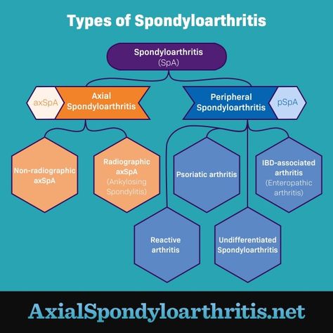 Non Radiographic Axial Spondyloarthritis, Pars Defect, Axial Spondyloarthritis, Doogie Howser, Body Science, Mom Health, Ehlers Danlos, Stomach Pain, Nerve Pain