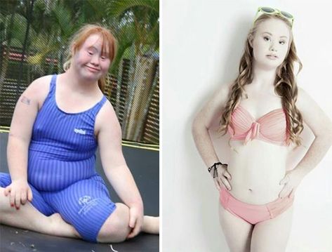 Small Minded People, Madeline Stuart, Become A Model, Becoming A Model, Transformation Body, Model Photos, Body Positivity, Beautiful People, Diet