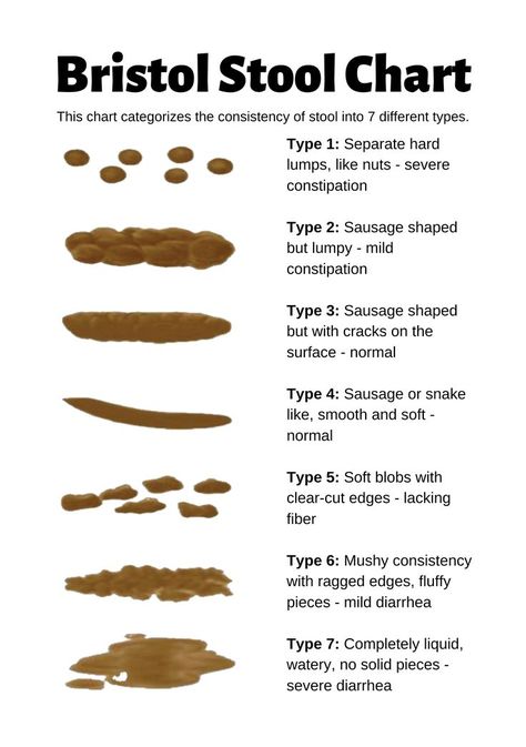 This Bristol Stool Chart categorizes the consistency of stool into 7 different types. Type 1: Separate hard lumps, like nuts - severe constipation 2: Sausage shaped but lumpy - mild constipation 3: Sausage shaped but with cracks on the surface - normal 4: Sausage or snake like, smooth and soft - normal 5: Soft blobs with clear-cut edges - lacking fiber 6: Mushy consistency with ragged edges, fluffy pieces - mild diarrhea 7: Completely liquid, watery, no solid pieces - severe diarrhea Bristol Stool, Bristol Stool Chart, Stool Chart, Bowel Movement, Nursing Study, Medical Knowledge, Elderly Care, Health Remedies, Bristol