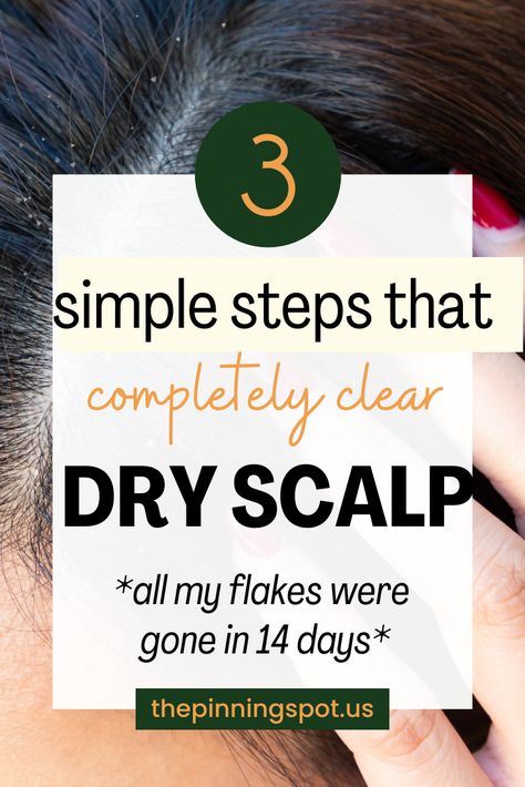 Are you struggling with an itchy, flaky scalp? Discover DIY tips and remedies to achieve a healthy scalp. We’ve gathered the best scalp health tips to help you banish scalp flakes and itchiness for good and say hello to a healthier scalp. You'll learn three simple yet effective steps to completely clear your dry scalp and how to have a scalp care routine that tackles dryness and flakes head-on.  No more flakes, just a healthy, nourished scalp Natural Dry Scalp Remedy, Itchy Dry Scalp Remedy, Get Rid Of Dry Scalp, Extremely Dry Scalp, Itchy Scalp Remedy, Dry Scalp Remedy, Sores On Scalp, Dry Flaky Scalp, Itchy Flaky Scalp