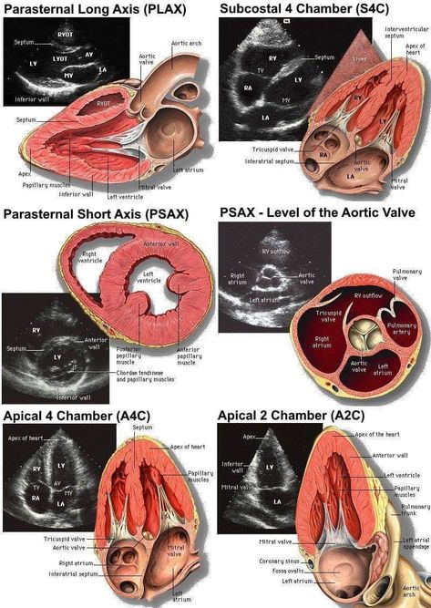 Pediatric Echocardiography, Medical Diagrams, Cardiac Sonography, Med School Study, Radiology Student, Diagnostic Medical Sonography, Studying Medicine, Medical School Life, Basic Anatomy And Physiology