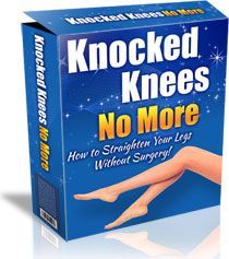 Sarah Brown's Knocked Knees No More PDF eBook download. Feel free to read now! Knocked Knees, Knee Valgus, Bow Legged Correction, Click Bank, Knock Knees, Sarah Brown, Bow Legged, Beauty Day, Perfect Legs