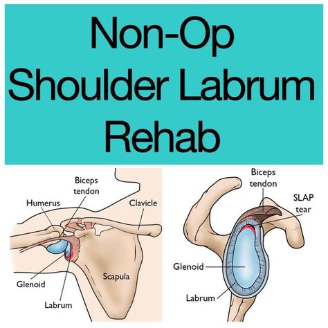 Dr. Stacie DPT, CSCS, FRC, USAW on Instagram: "📍Shoulder Labrum Rehab📍 🤦‍♀️Not so fun fact: I tore both of my labrums...I ended up needing the surgery on the right, then another, & another. So when I found out my left was also torn, I decided to just rehab it on my own instead of the surgery. If you’re counting, that was 3 surgeries on my right, & no surgeries on my left. These days, BOTH are just FINE, I can do anything & everything I want, rock climbing, Olympic weightlifting, I can even st Torn Labrum Shoulder, Torn Labrum, Shoulder Rehab, Rotator Cuff Tear, Shoulder Impingement, Shoulder Injuries, Rotator Cuff, Shoulder Pain, Fitness Planner