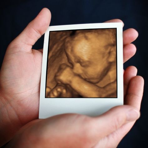 INNERVIEW ULTRASOUND - 3D/4D IMAGING Ultra Sound, 3d Ultrasound, 4d Ultrasound, Baby Art, Prenatal, Ultrasound, Philadelphia Pa, Mothers Love, Philadelphia