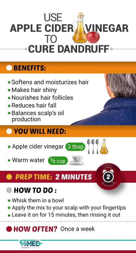 How to Get Rid of Dandruff?! Vinegar For Dandruff, Natural Dandruff Remedy, Hair Mask For Dandruff, Dandruff Solutions, Home Remedies For Dandruff, Vinegar For Hair, Rid Of Dandruff, Apple Cider Vinegar For Hair, Homemade Hair Treatments