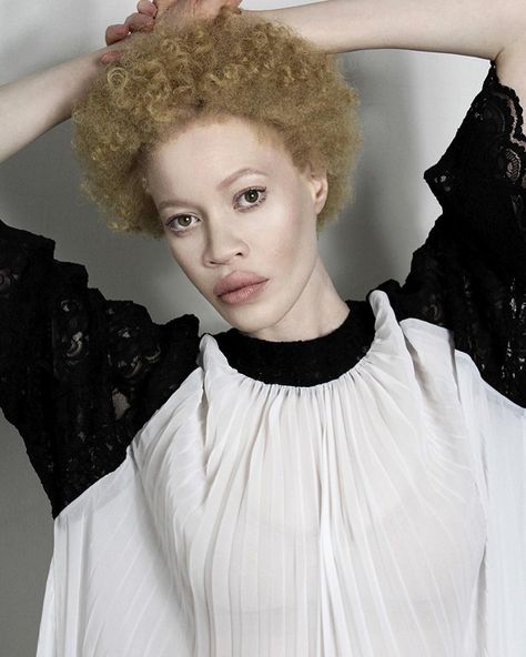 Lola Chuil, Albino People, Stephen Thompson, Winnie Harlow, Signature Style, World Of Fashion, Chef's Jackets, Fashion Photography, Vogue