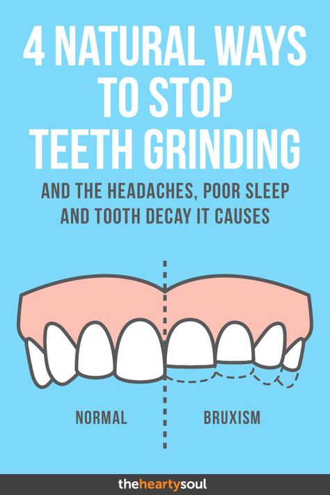 4 Natural Ways to Stop Teeth Grinding and the Headaches, Poor Sleep and Tooth Decay It Causes Teeth Remedies, Liver Issues, Teeth Grinding, Pediatric Dentist, Oral Care Routine, Periodontal Disease, Receding Gums, Grinding Teeth, Oral Health Care