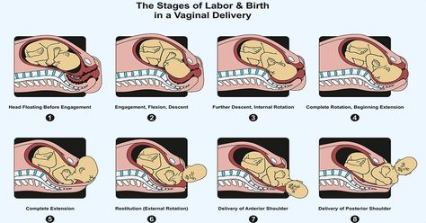 Follow simple tips for normal delivery of a healthy baby. MomJunction gives you the symptoms, process, and safety tips for a normal delivery. Read on! Diagram Infographic, Healthcare Illustration, Infographic Diagram, Midwifery Student, Stages Of Labor, Normal Delivery, Birth Labor, Mom Junction, Medical Science