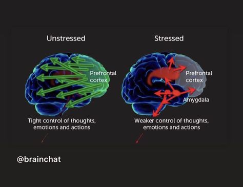 Brain Scan Neuroscience, Psychology Neuroscience, Brain Anatomy And Function, Brain Disorders, Hair Tomboy, Motivation Psychology, Brain Facts, Brain Anatomy, Brain Scan