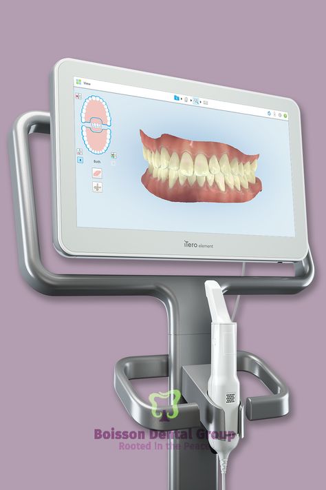 iTero scanners play an important role in CEREC (Chairside Economical Restorations of Esthetic Ceramic) dentistry. The iTero’s intraoral digital image is converted to a three-dimensional virtual model of your prepped tooth. All of this is done in a single appointment! Get in touch to learn more about CEREC restorations: ☎️ 587-771-7668 info@boissondental.ca #boissondentalgroup #GrandePrairieDentist #DentistGrandePrairie #FamilyDentistGrandePrairie #Boissondentalgroup Itero Scanner, Digital Dentistry, Dental Restoration, Dental Work, Dentistry Student, Air Filtration System, Family Dentist, Dental Surgery, Dental Office