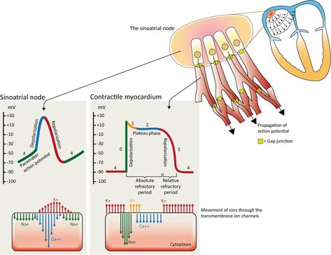 Figure 7. The action potential in the sinoatrial node and in contractile myocardial cells. Phase 4 of the action potential in the sinoatrial node is called 'pacemaker potential', because it is responsible for the spontaneous repetitive depolarization. Sinoatrial Node, Action Potential, Cardiac Sonography, Cardiogenic Shock, Cardiac Cycle, Ecg Interpretation, Cardiac Nursing, Respiratory Therapy, Medical School Studying