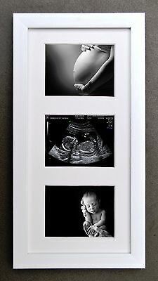 Pregnancy Scan, Foto Kelahiran, Vom Avea Un Copil, Perlengkapan Bayi Diy, طفلة حديثة الولادة, Birth Art, Baby Picture Frames, Idee Babyshower, Baby Scan