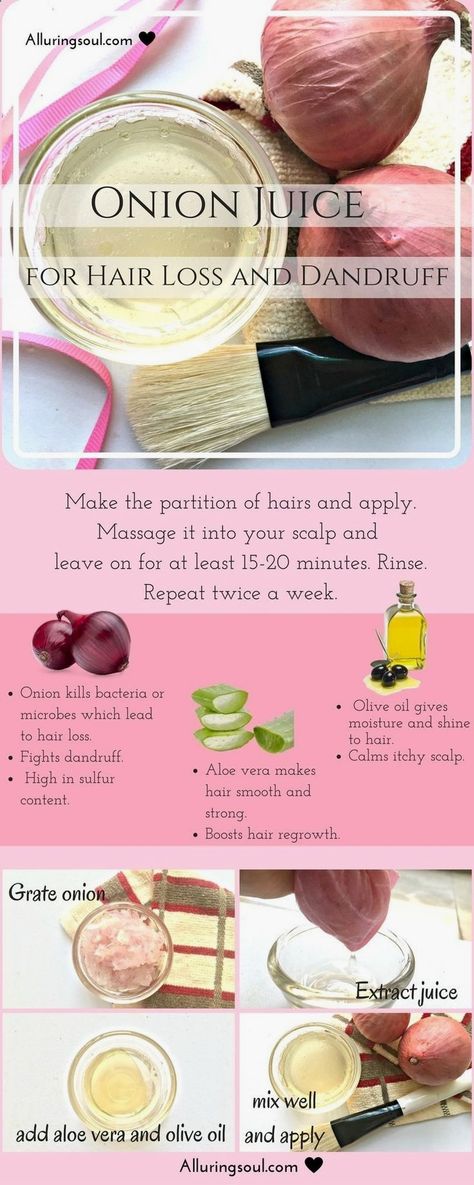 Onion Hair Mask, Juice For Hair, Onion Juice For Hair, Mask For Hair, Onion Hair, Hair Problem, Thick Hair Remedies, Scalp Problems, Onion For Hair