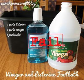 Sarah Jane's Craft Blog: As Seen on Pinterest: Vinegar and Listerine Foot Soak Nature Decor Diy, Diy Vinegar, Foot Detox Soak, Listerine Foot Soak, Diy Foot Soak, Foot Soak Recipe, Diy Pedicure, Pedicure At Home, Athletes Foot