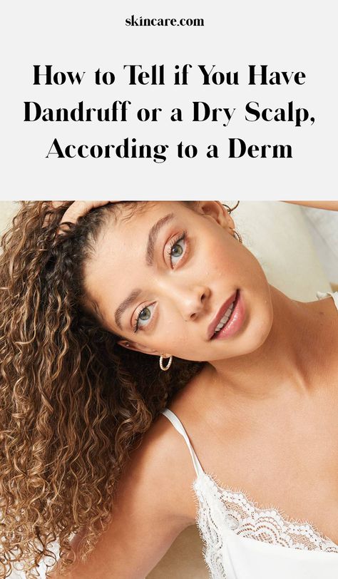 The Difference Between Dry Scalp and Dandruff How To Stop Dandruff Dry Scalp, White Flakes In Hair Dry Scalp, How To Stop Itchy Scalp, Dry Flaky Scalp Remedy, Flaky Scalp Remedy, Dry Scalp Vs Dandruff, How To Stop Dandruff, Scalp Scabs, Haircare Ideas